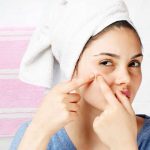 How to get rid of a pimple overnight