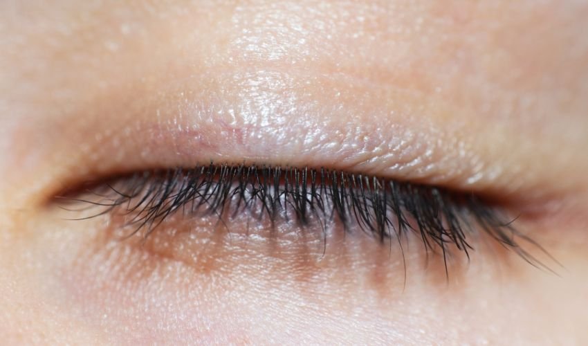 Short eyelashes